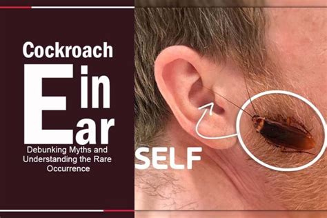 Cockroach In Ear A Horror Story That Could Happen To You