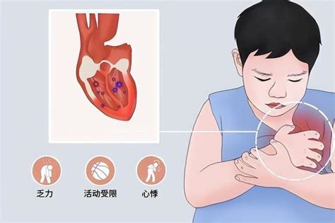 感冒引起的病毒性心肌炎，到底是怎麼回事？ 每日頭條