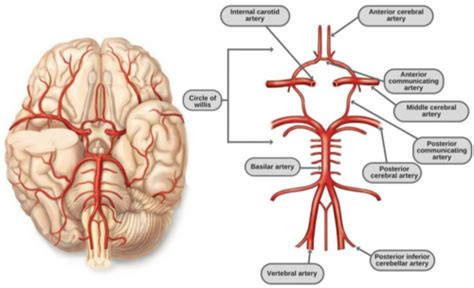 CVA Stroke Flashcards Quizlet