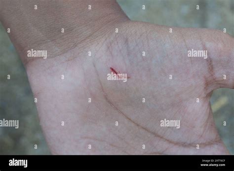 Hand Cut Blood Bleeding Hi Res Stock Photography And Images Alamy