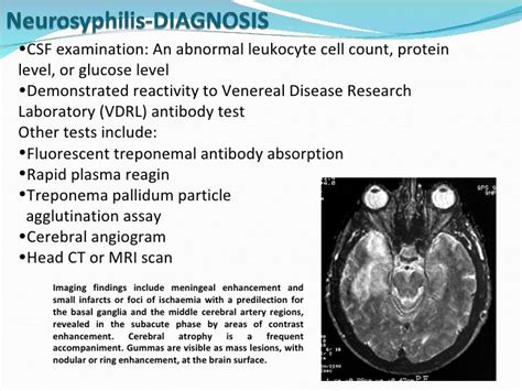 Cns infections Lecture