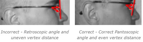 Spectacle Frame Alignment Vision Magazine Online