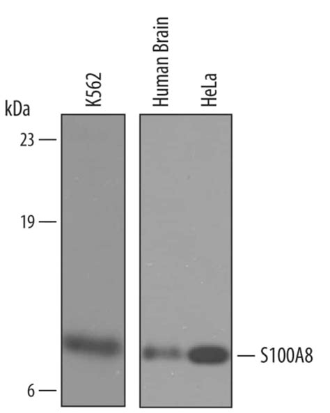 Human S100A8 Antibody R D Systems 100μg Unlabeled Antibodies