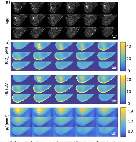 Figure 7 From Heterodyne Frequency Domain Multispectral Diffuse Optical