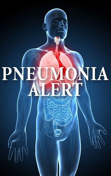 Pneumonia Symptoms How To Accelerate Recovery From Pneumonia And Avoid Additional