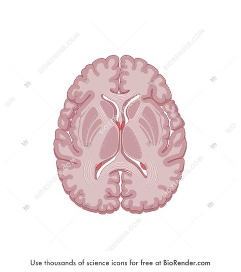 Free Brain Horizontal Cut At Thalamus With Choroid Plexus Icons