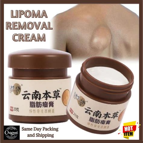 Lipoma Removal Cream Best Seller Effectively Reduces Inflammation