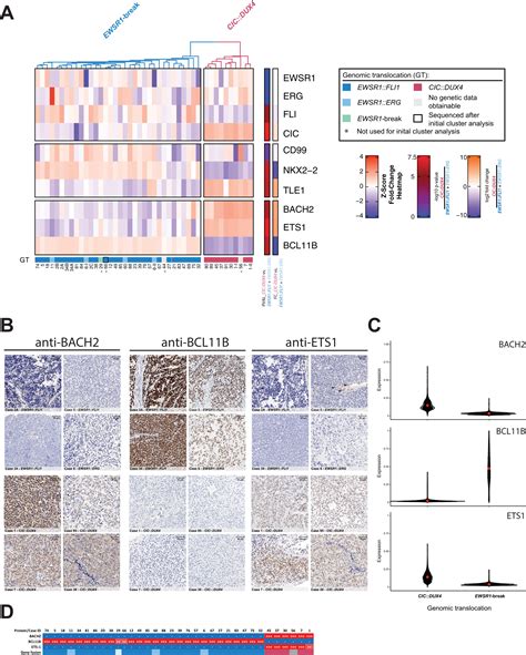 Proteomic Characterization Of Undifferentiated Small Round Cell