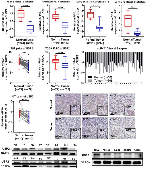 Usp Is Significantly Downregulated In Ccrcc Clinical Samples And Cell