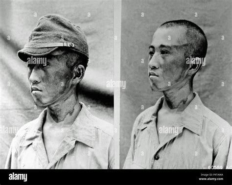 Atomic bomb hiroshima victim hi-res stock photography and images - Alamy