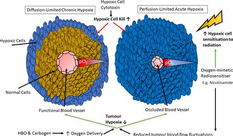 Hypoxia And Its Modification In Bladder Cancer Current And Future