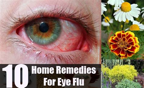 10 Effective Home Remedies For Eye Flu