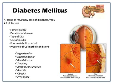 Ppt Ocular Manifestations Of Systemic Diseases Dr Turki Al Turki