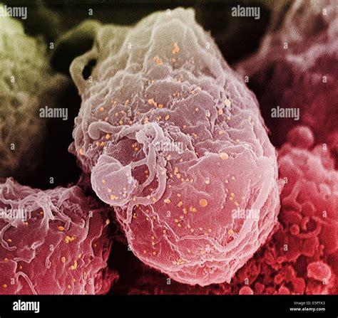 Scanning Electron Microscope Virus