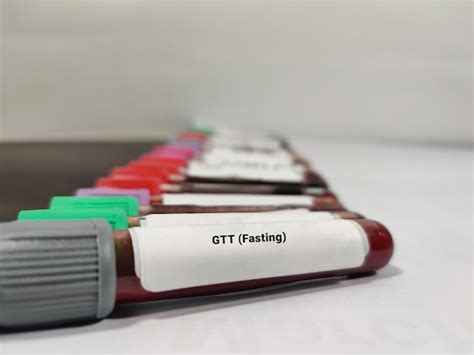 Amostra de sangue para teste de tolerância à glicose em jejum gtt