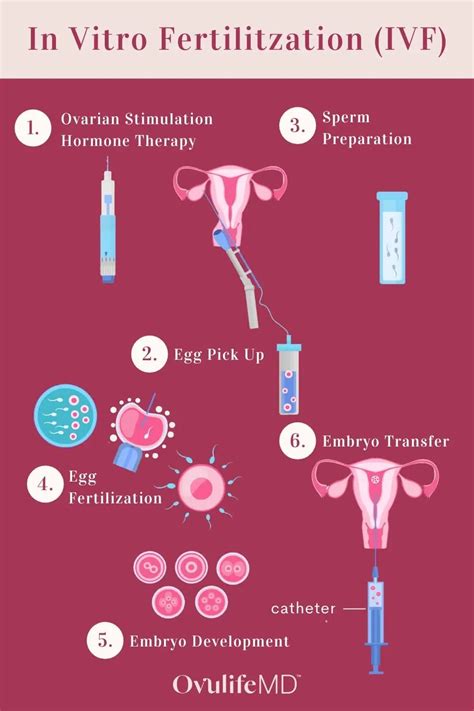 In Vitro Fertilization Process Here S An Infographic Showing The