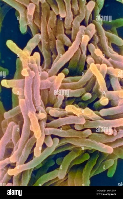 Tuberculosis bacteria. Coloured scanning electron micrograph (SEM) of Mycobacterium tuberculosis ...