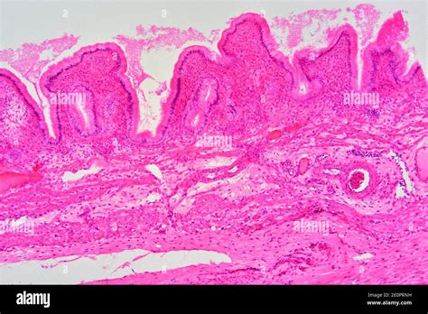 Gallbladder Histology Labeled