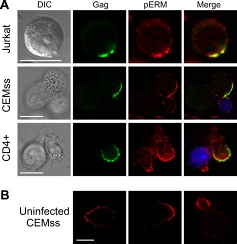 Ezrin Is A Component Of The Hiv Virological Presynapse And