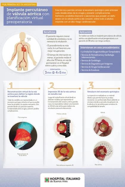 Por Primera Vez En El País Implantaron Una Válvula Aórtica Con Una