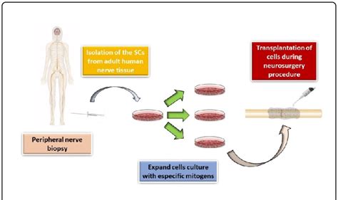 Schematic Representation Of Autologous Schwann Cells Transplantation In Download Scientific