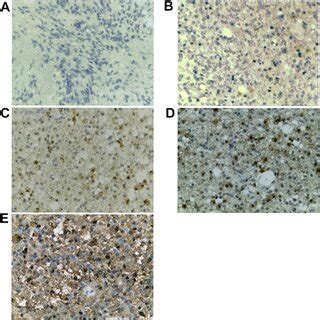 Representative Immunohistochemical Staining Of Oip Expression In