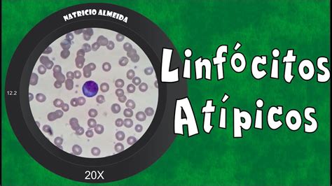 Linfócitos Atípicos 0 O Que Significa - O Que São Linfócitos Atípicos - RETOEDU