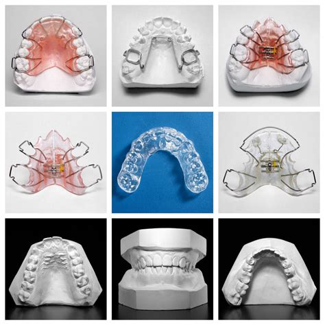 Essix Retainer Surrounded By Orthodontic Appliances And Models Hardy Pediatric Dentistry