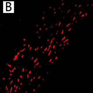 Representative Photograph Of Immunohistochemical Examination For Fxr In