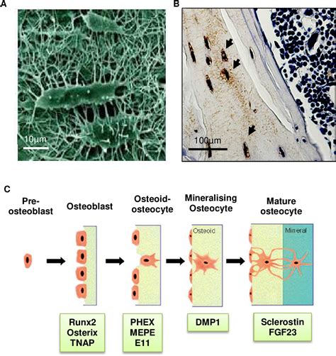 Figure 1.1 from Role of osteocyte markers in medial vascular calcification | Semantic Scholar