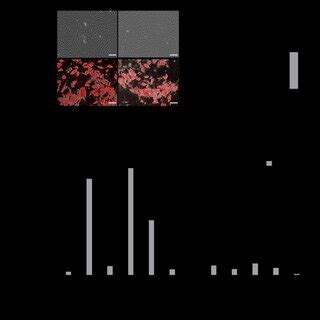 Adipocyte Differentiation Of Ascs Populations Ascs From Normal And