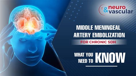 Middle Meningeal Artery Embolization For Chronic Sdh