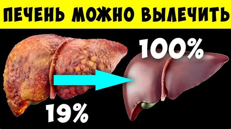 Супер-еда для чистки Печени и Желчного Пузыря! 17 продуктов для ...