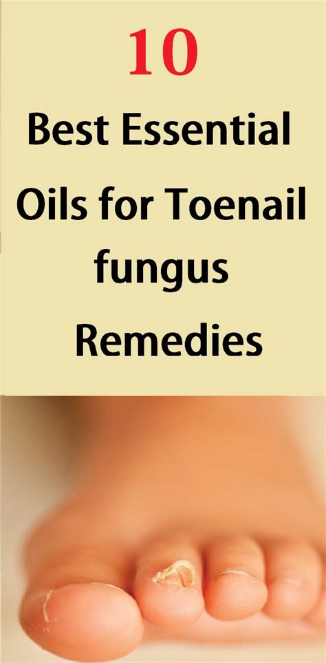 10 Best Essential Oils For Toenail Fungus Remedies Health And Beauty Best Essential Oils