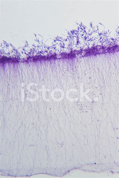 Penicillium Under Microscope stock photos - FreeImages.com