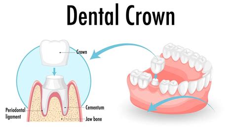 Tooth Nerve Pain: Causes, Symptoms & Treatments