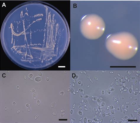 Taphrina Betulina Morphology A T Betulina Yeast Cells After