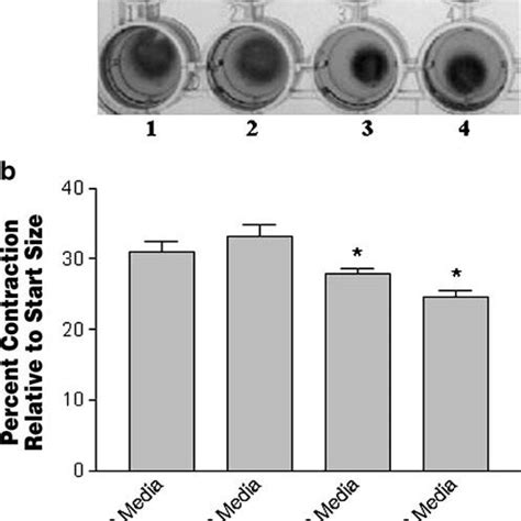 The Effect Of High And Low Glucose On Fibroblast Mediated Collagen Gel