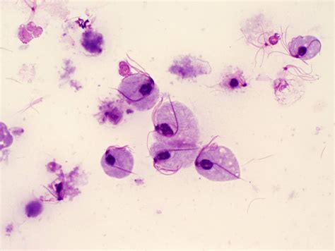 Trichomonas Vaginalis Slide