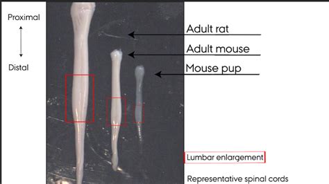 Hydraulic Extrusion Of The Spinal Cord And Isolation Of Dorsal Root Ganglia In Rodents