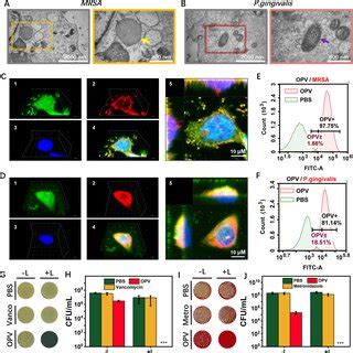 OPV Binding And Killing Effect On Intracellular Bacteria A B TEM