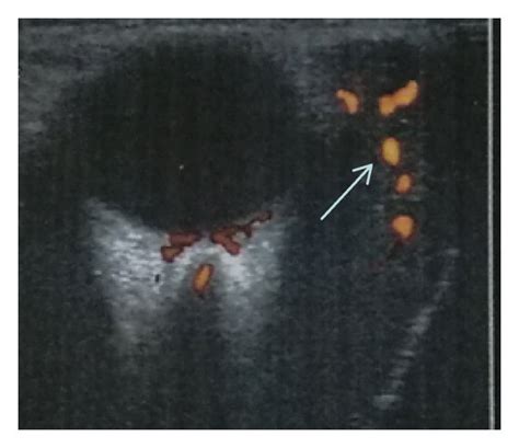 A B C Preoperative Appearance Of The Right Eye CT And MRI