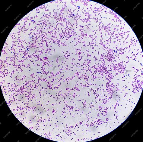 Premium Photo | Microscopic view of gram stain showing Escherichia coli ...