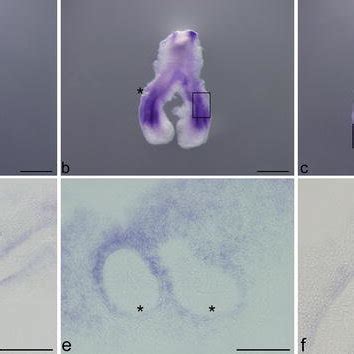 smo expression pattern in early stages of chick lung development ... 