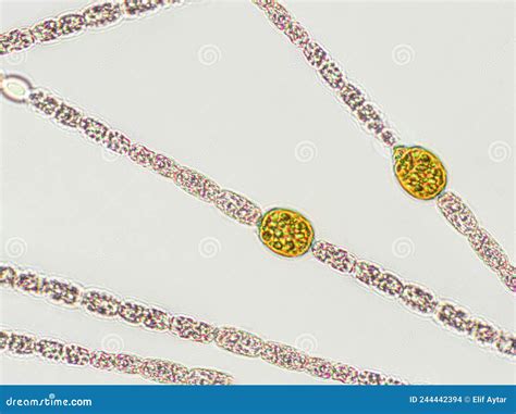 Red Algae Under The Microscope Royalty-Free Stock Photo | CartoonDealer ...