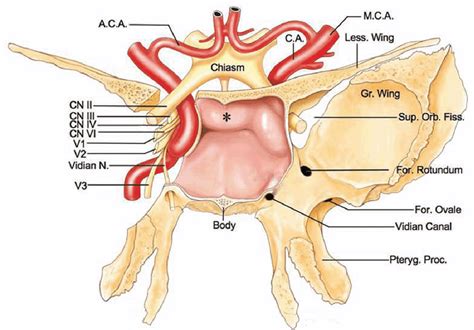 The Sphenoid Sinus Clinical Imaging Anatomy And Pathology Semantic