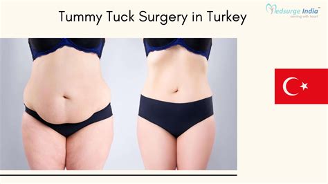 Tummy Tuck Surgery Cost In Turkey Medsurge India