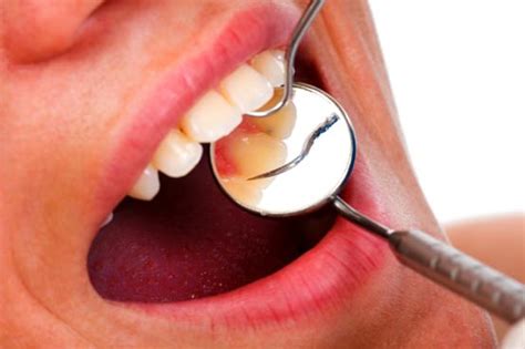 Oral Diseases Which Are The Most Common From Doctor