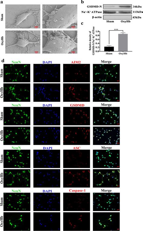 Pyroptosis In Primary Cortical Neurons A Representative Scanning Download Scientific Diagram