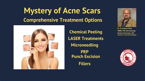 Addressing Acne Scars A Comprehensive Guide To Treatment Options